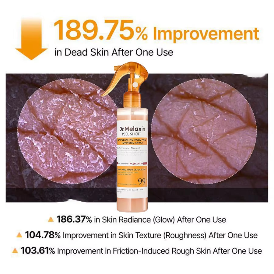 Kojic Acid Turmeric Exfoliating Spray 200Ml | Body Keratin Care | Gentle Exfoliation | Leaves Skin Radiant