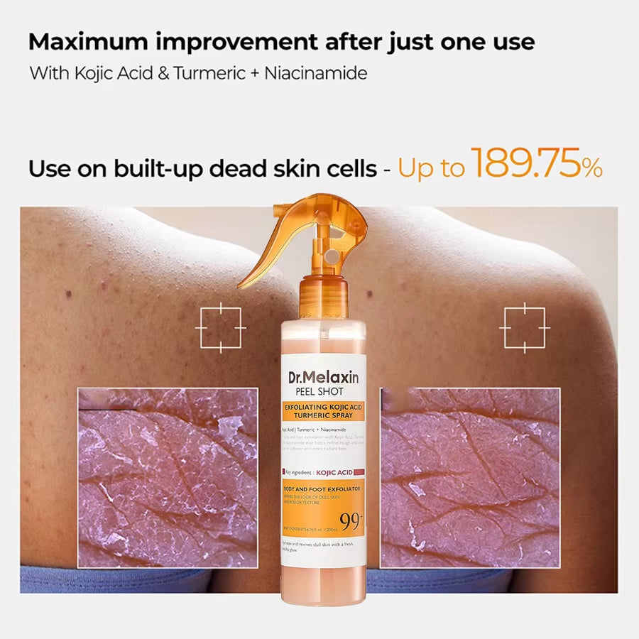Kojic Acid Turmeric Exfoliating Spray 200Ml | Body Keratin Care | Gentle Exfoliation | Leaves Skin Radiant